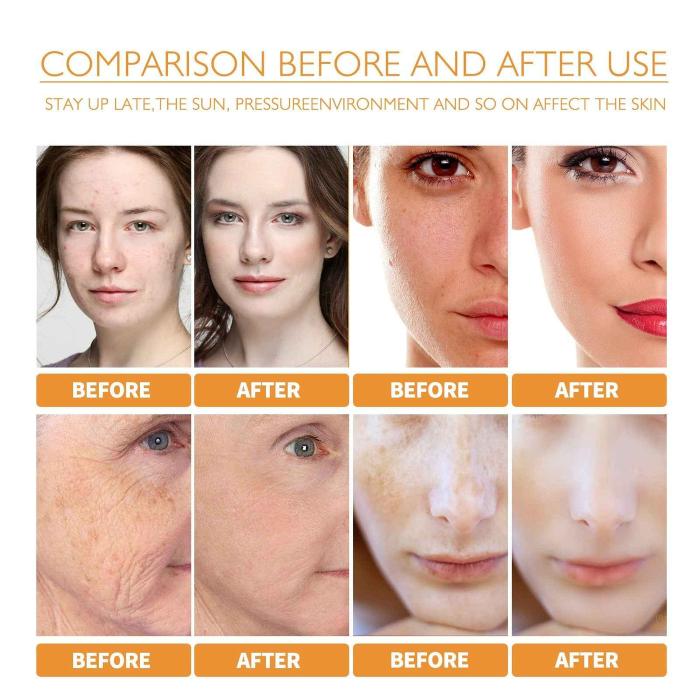 Turmeric Facial Smallpox Diluting Refreshing Oil Control