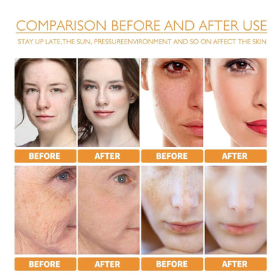 Turmeric Facial Smallpox Diluting Refreshing Oil Control