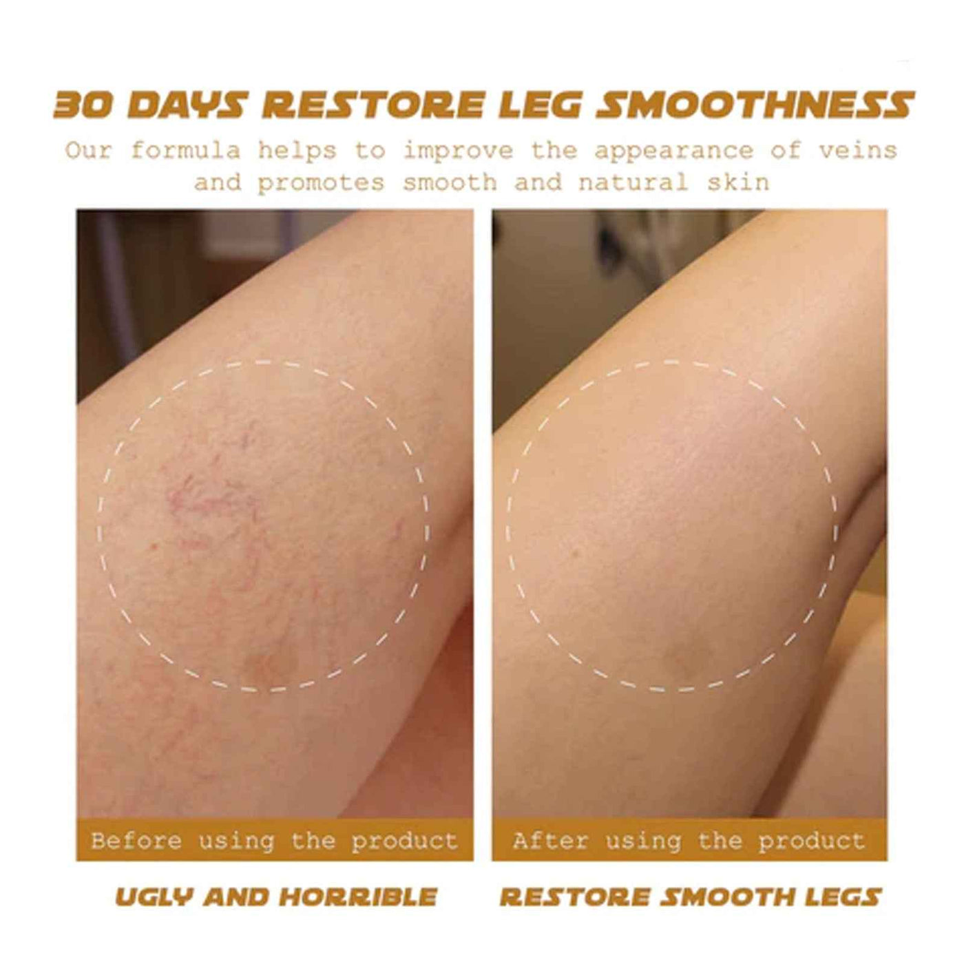 Intravenous Massage Qu Zhang Cream Relieves Soreness